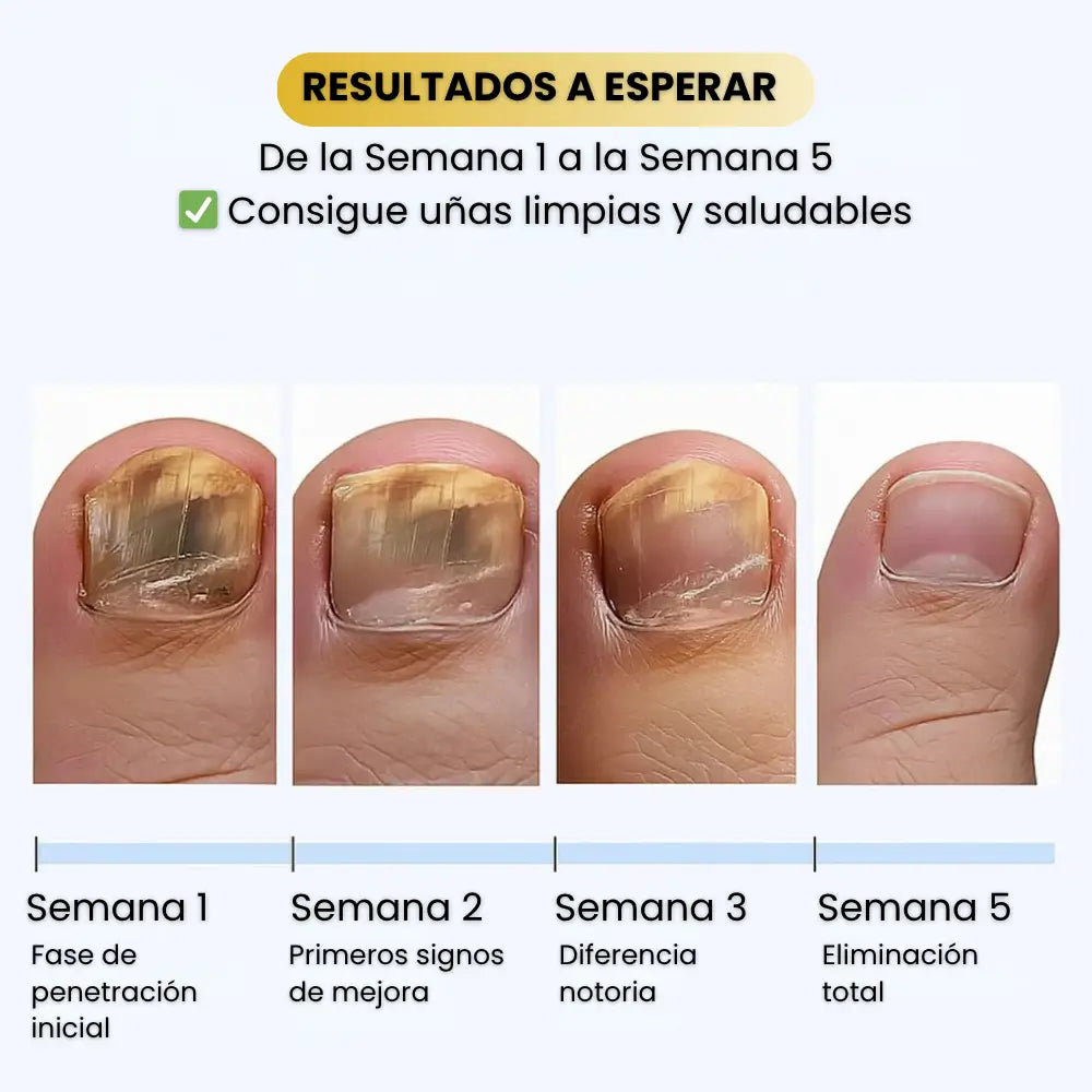 PARCHES ANTI-HONGOS PARA UÑAS
