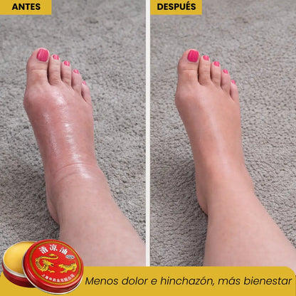 MIRACLE TIGER BALM - POMADA DE ALIVIO ARTICULAR Y MUSCULAR